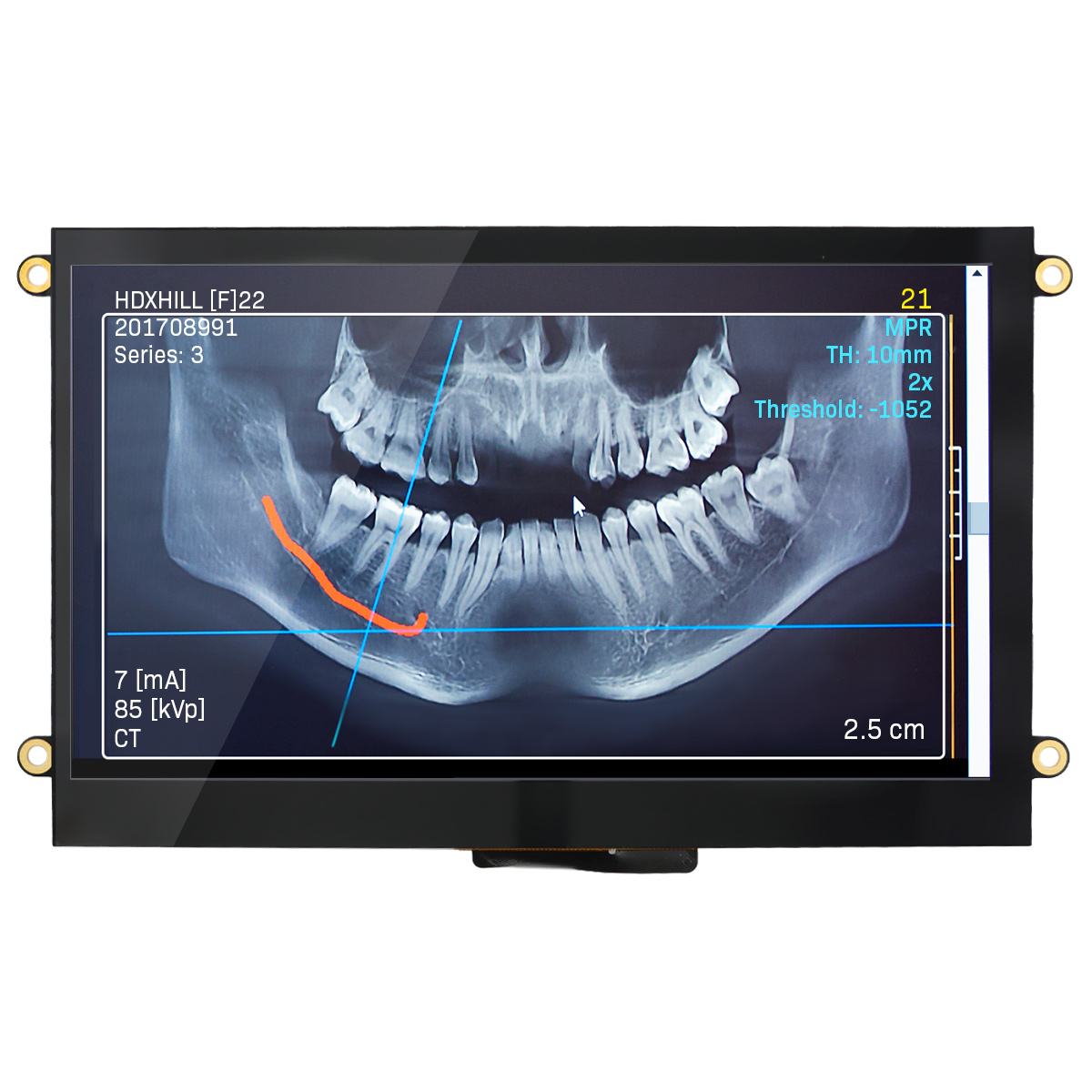 NHD-7.0-800480FT-CSXP-CTP
