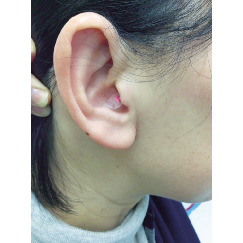 聴覚保護具クオリネ ピンク【QUALINE-MP】